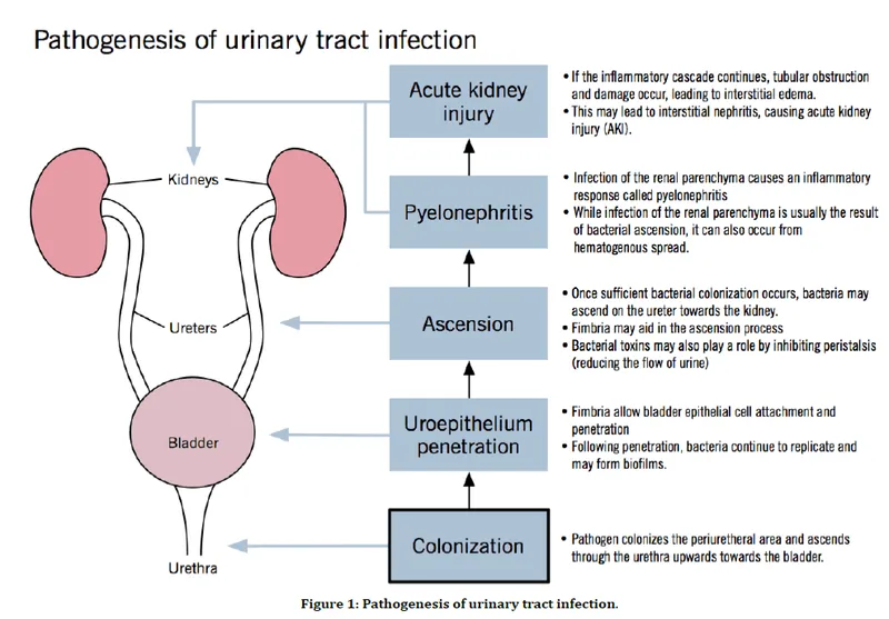 Pathogenesis of Urinary Tract Infection