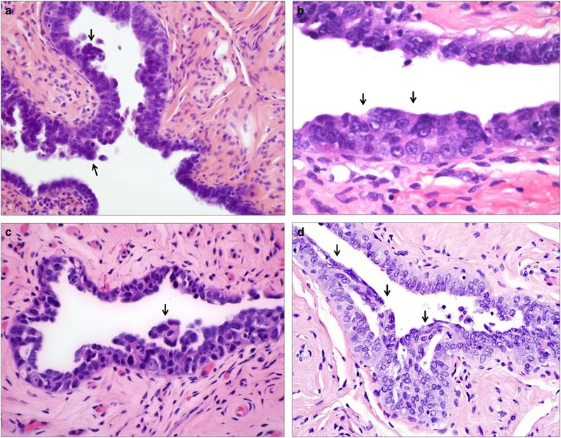 Fallopian tube pathology highlights
