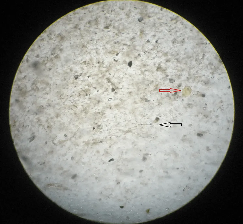 Microscopic view of vaginal flora