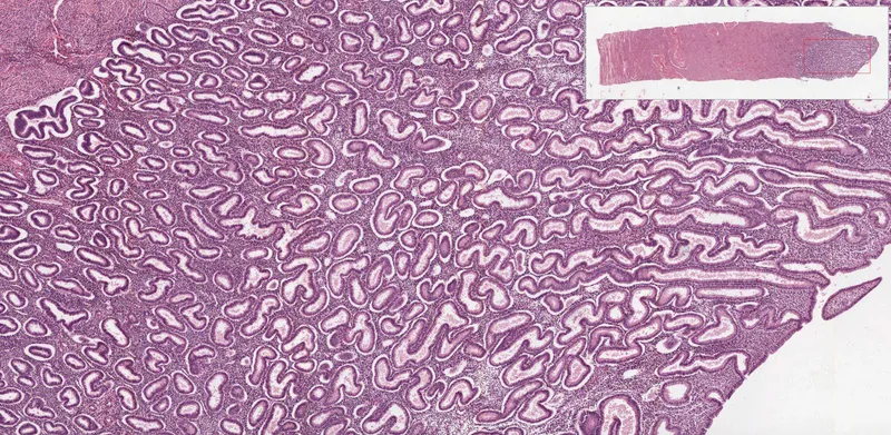 Proliferative vs Secretory Endometrium Histology