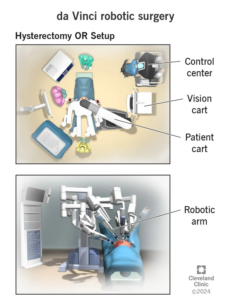 da Vinci Robotic Surgery OR Setup and Robotic Arm