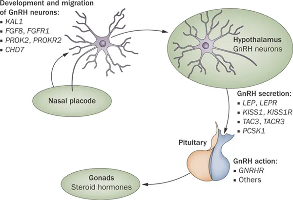 GnRH neuron migration defect in Kallmann syndrome