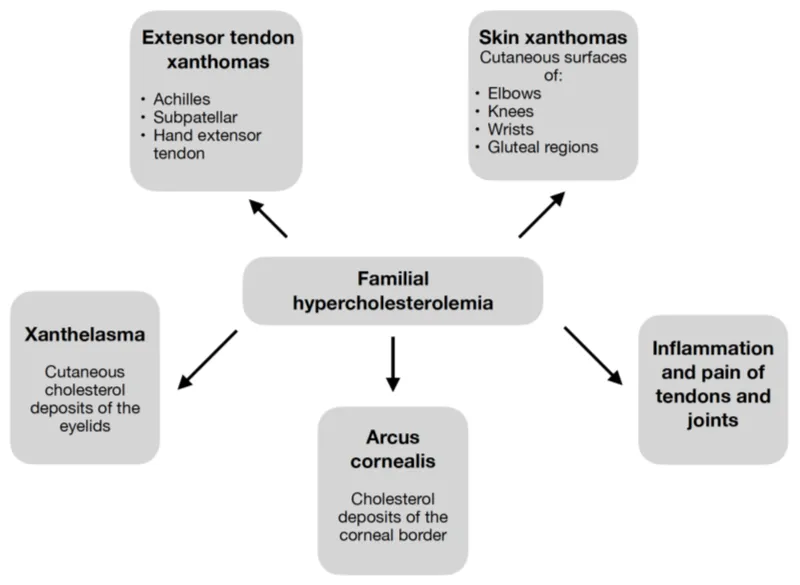 Familial Hypercholesterolemia Manifestations