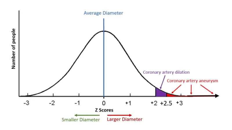 Coronary artery Z-score classification in Kawasaki Disease