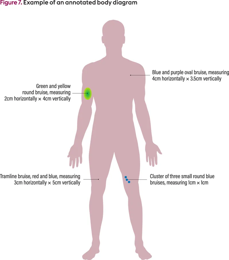 Annotated body diagram for documenting child abuse
