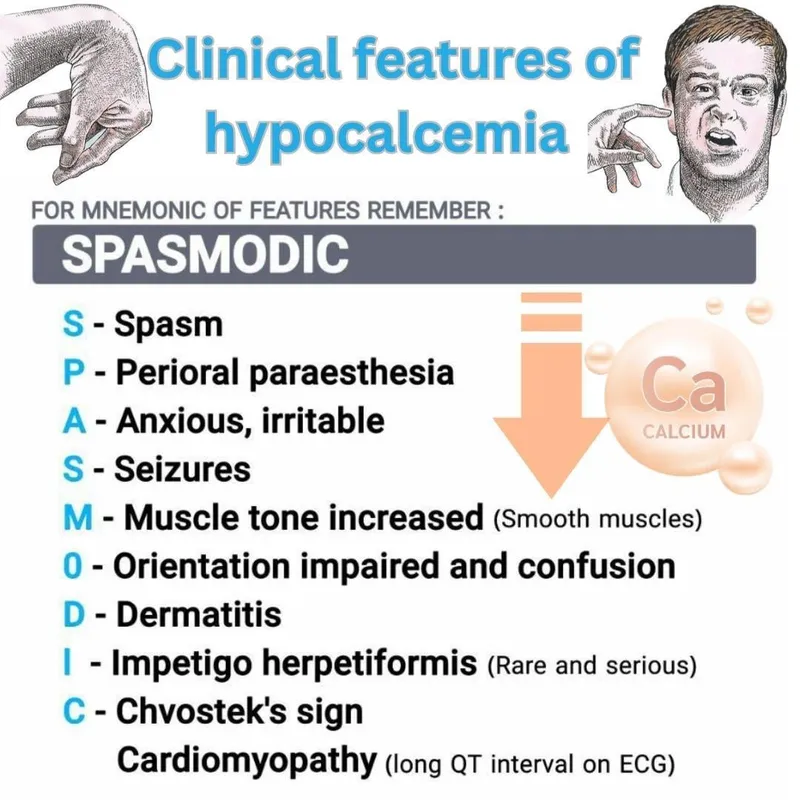 Clinical features of hypocalcemia (SPASMODIC mnemonic)
