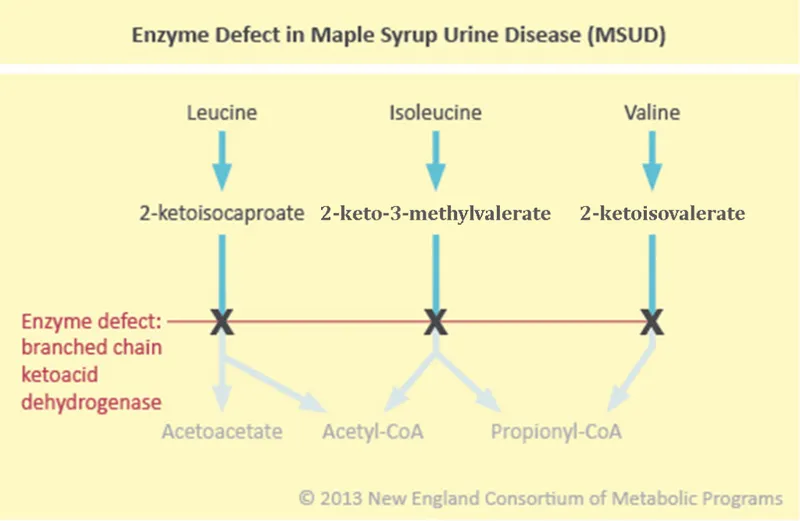 MSUD Enzyme Defect