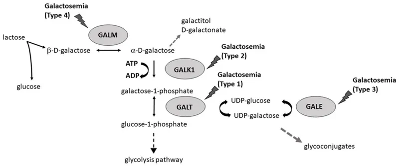 Galactose Metabolism Pathway and Galactosemia Types