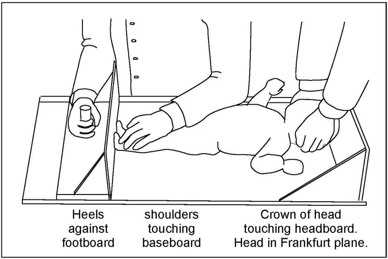 Measuring infant supine length using an infantometer