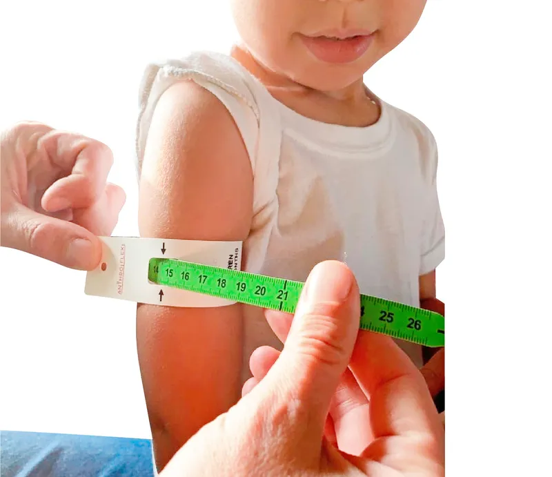 Child receiving MUAC measurement