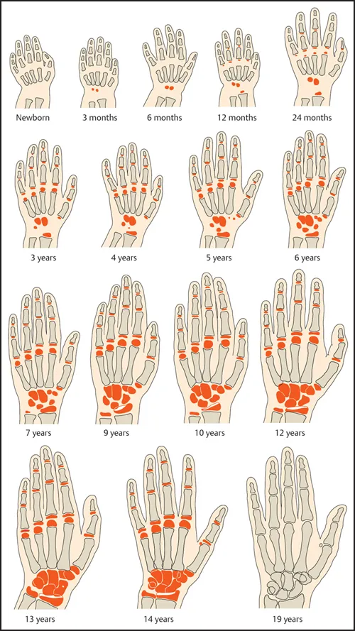 Greulich-Pyle Bone Age Atlas: Hand & Wrist Development