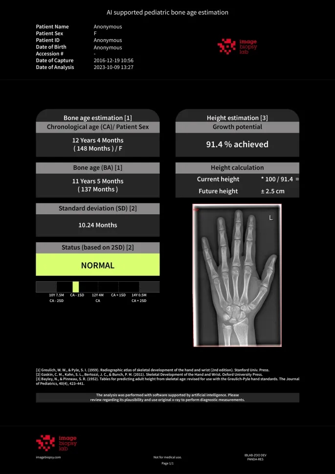 AI-supported pediatric bone age and height estimation
