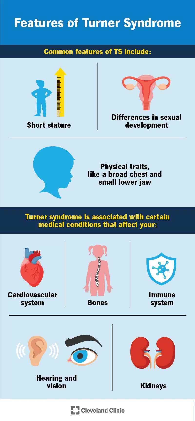 Features of Turner Syndrome