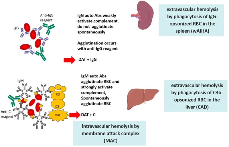 Intravascular vs Extravascular Hemolysis Mechanisms