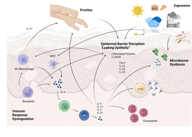 Atopic Dermatitis Pathophysiology