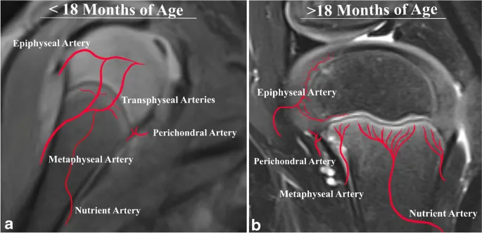 Vascular supply of proximal humerus in children