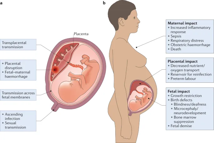 Routes and impact of congenital infections