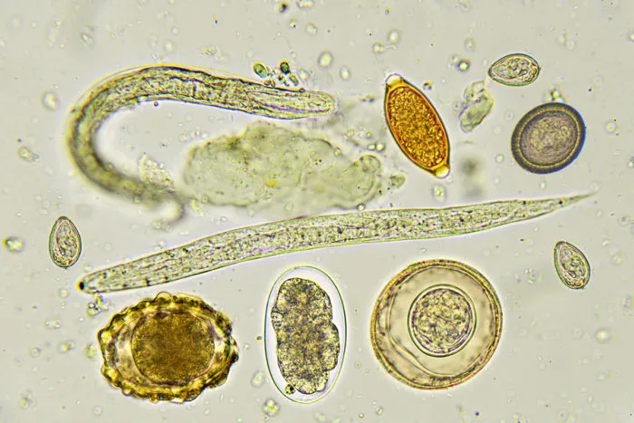 Microscopic view of various gastrointestinal parasites
