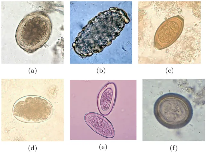 Microscopy of various intestinal parasite eggs