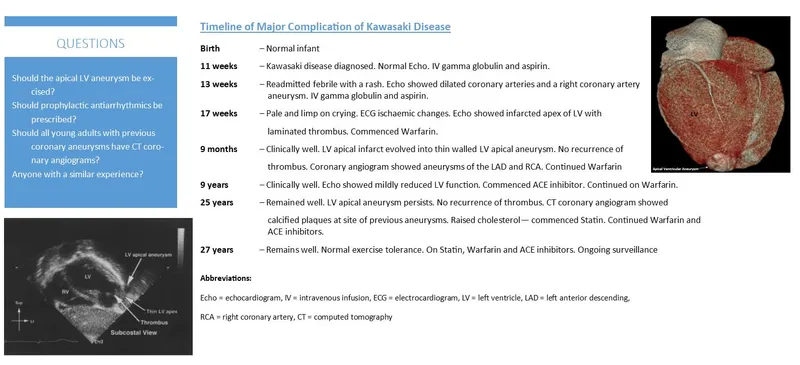 Kawasaki Disease Complication Timeline & Imaging