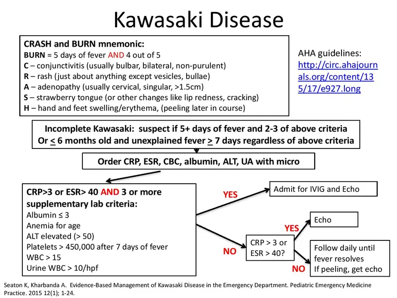 Kawasaki Disease: CRASH & BURN Mnemonic and Diagnostic Flow
