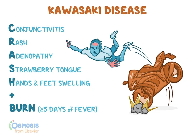 Kawasaki Disease: CRASH + BURN mnemonic