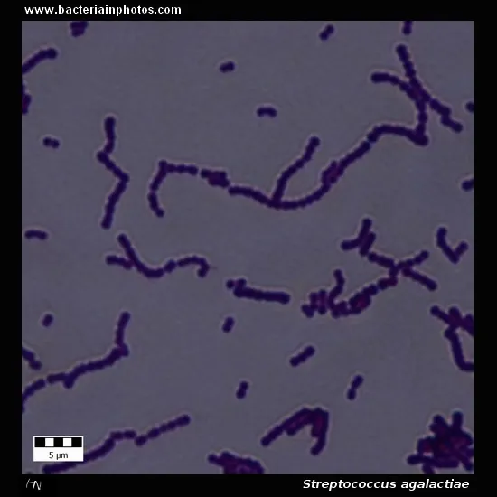 Streptococcus agalactiae (Group B Strep) Gram stain