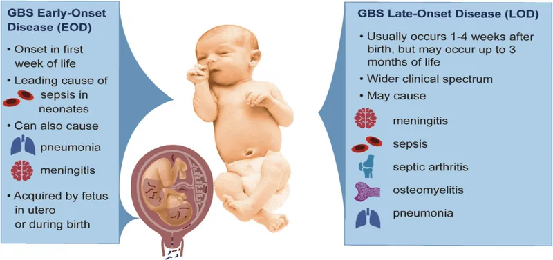 GBS Early-Onset vs. Late-Onset Disease in Neonates