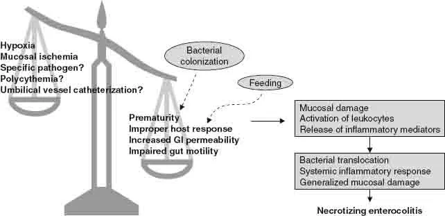 Pathophysiology of Necrotizing Enterocolitis