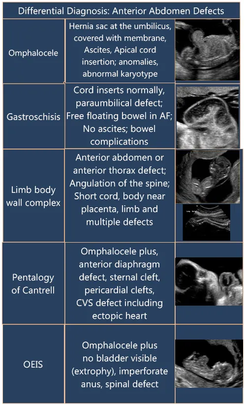 Differential Diagnosis: Anterior Abdomen Defects