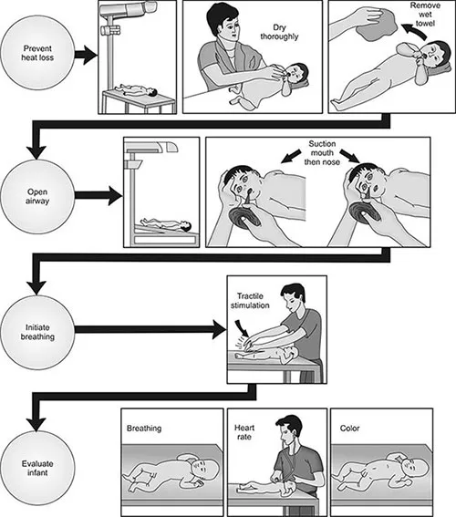 Neonatal Resuscitation Initial Steps Diagram