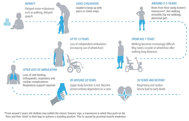 Progression of Duchenne Muscular Dystrophy