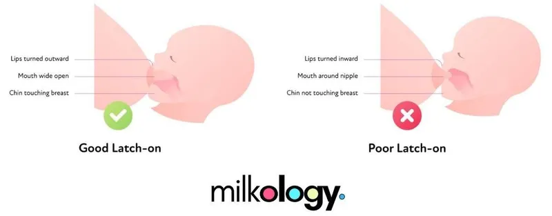 Good vs. Poor Breastfeeding Latch
