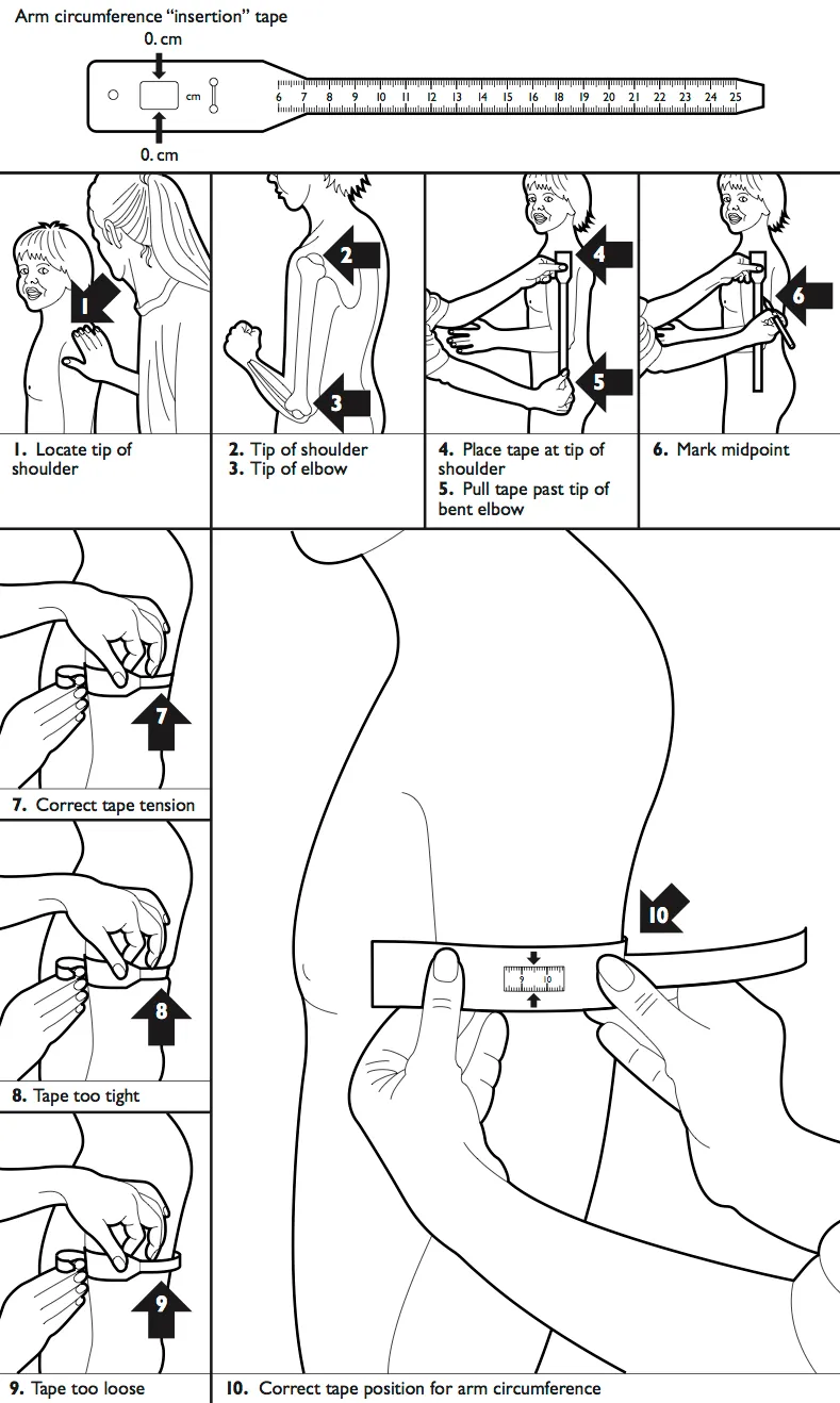 Measuring Mid-Upper Arm Circumference (MUAC) in Children