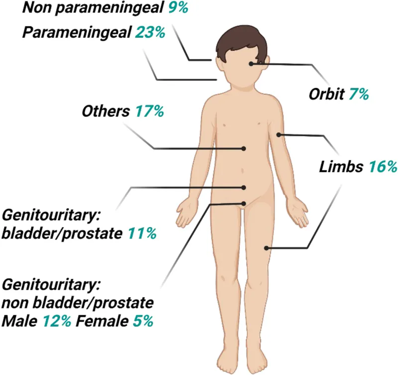 Common sites of Rhabdomyosarcoma