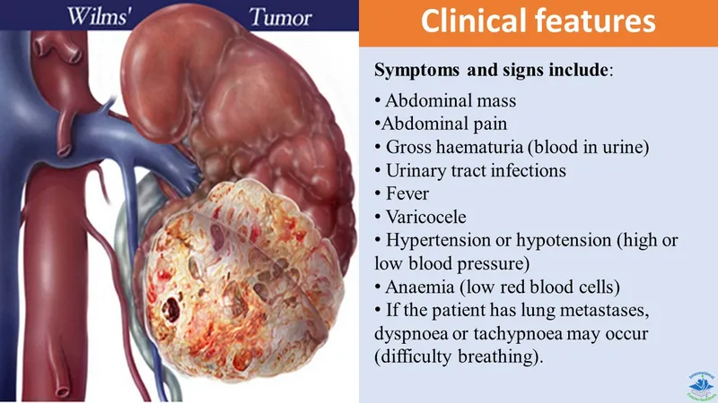 Wilms Tumor Clinical Features