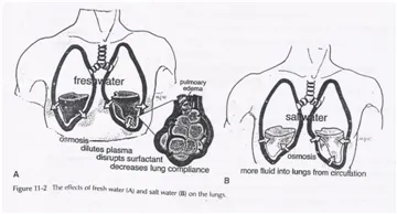 Fresh vs Saltwater Drowning Effects on Lungs