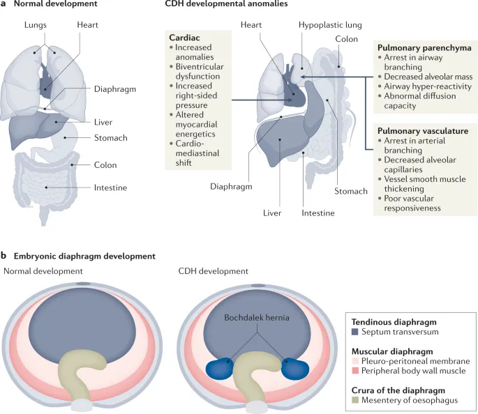 CDH development and anomalies