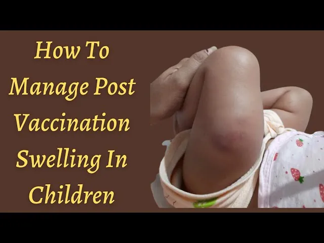 Infant thigh with post-vaccination swelling and redness