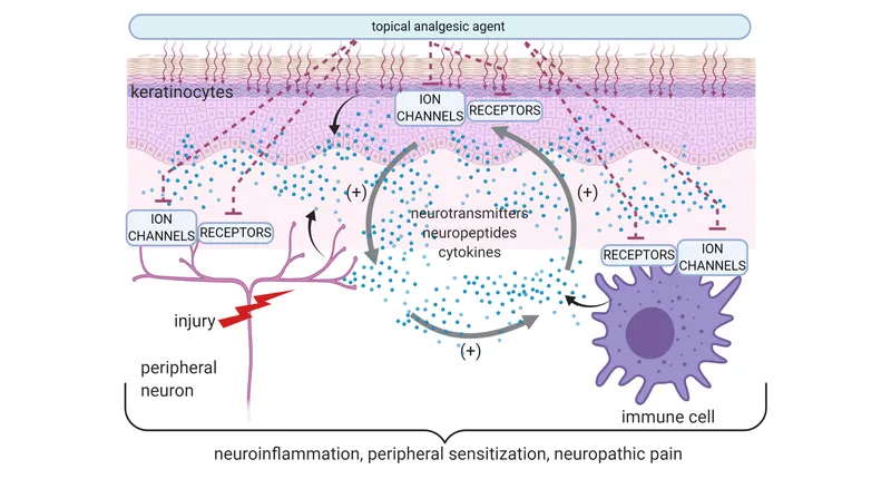 Mechanisms of Neuropathic Pain