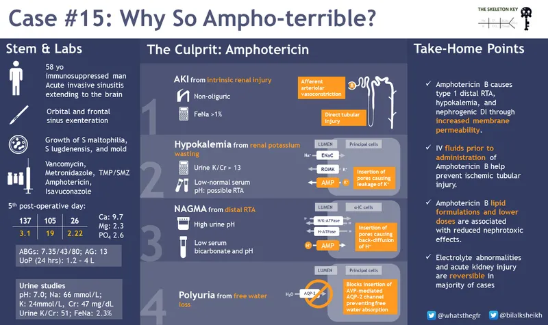 Amphotericin B Nephrotoxicity & Electrolyte Wasting