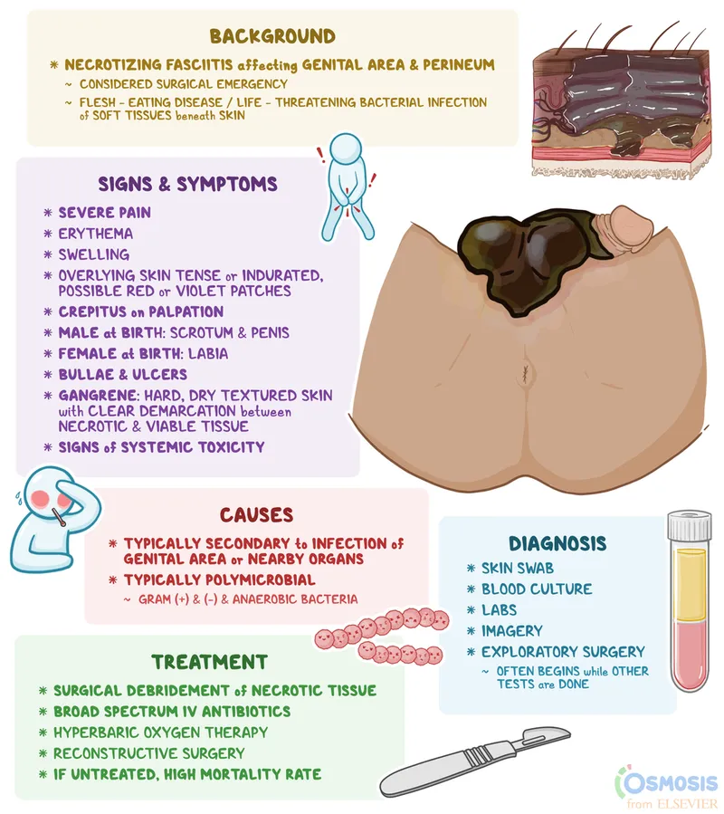 Fournier's Gangrene: Signs, Symptoms, Causes, Treatment