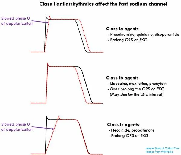 Class I antiarrhythmics effect on cardiac action potential