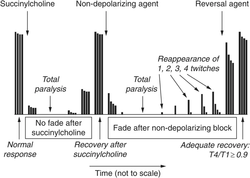 Neuromuscular block: Succinylcholine vs Non-depolarizing
