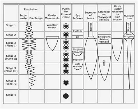 Guedel's Stages of Anesthesia Chart