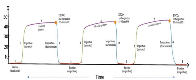 Normal Capnography Waveform