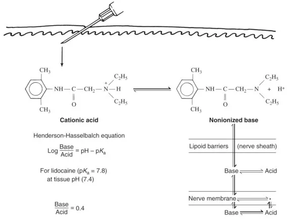 Local Anesthetic Mechanism: pH, Ionization, Nerve Block