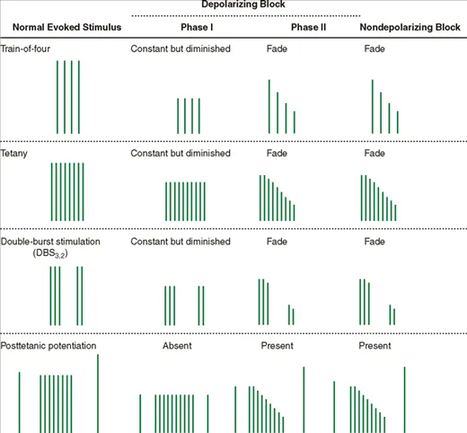 Neuromuscular Blockade: Stimulus Response Patterns