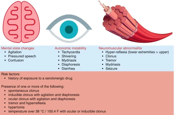 Clinical Triad of Serotonin Syndrome