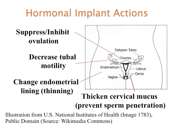 Hormonal Implant Actions on Female Reproductive System